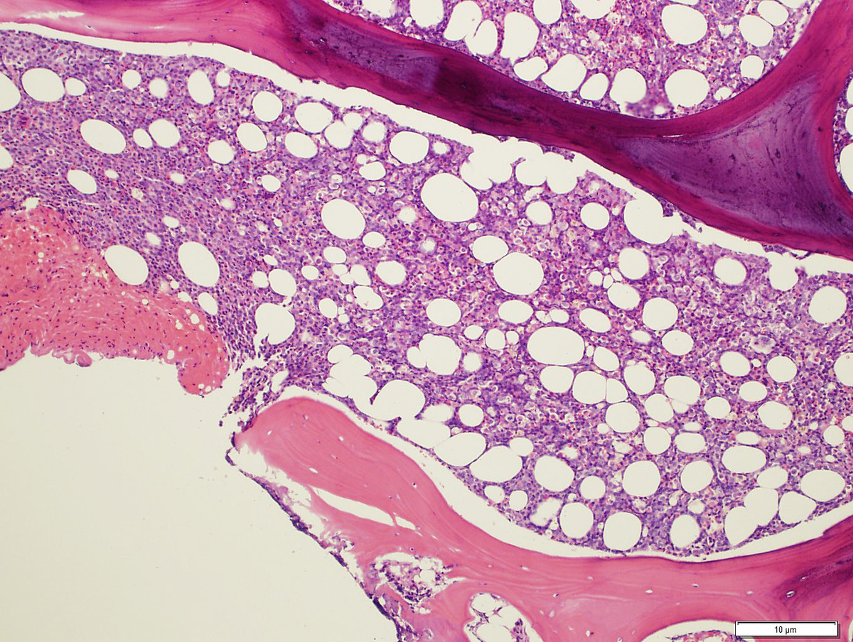 Bone marrow core biopsy, H&E, 10x